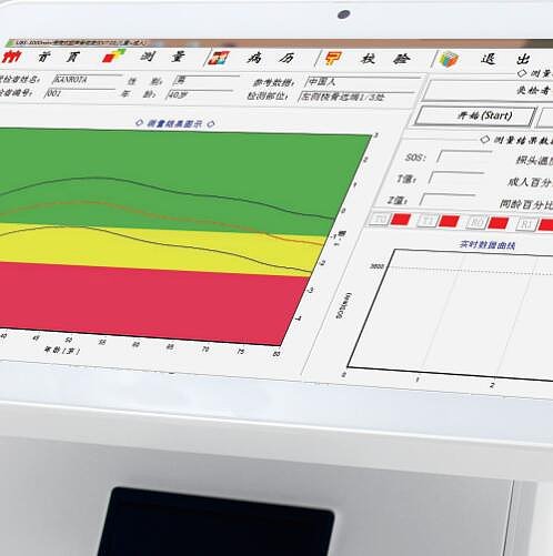 康荣信 便携式超声骨密度仪 UBS-3000mini+（便携式）产品优势