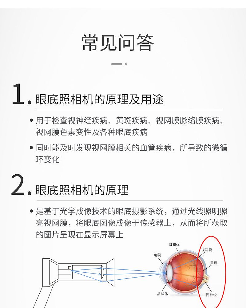 眼底照相机_07.jpg