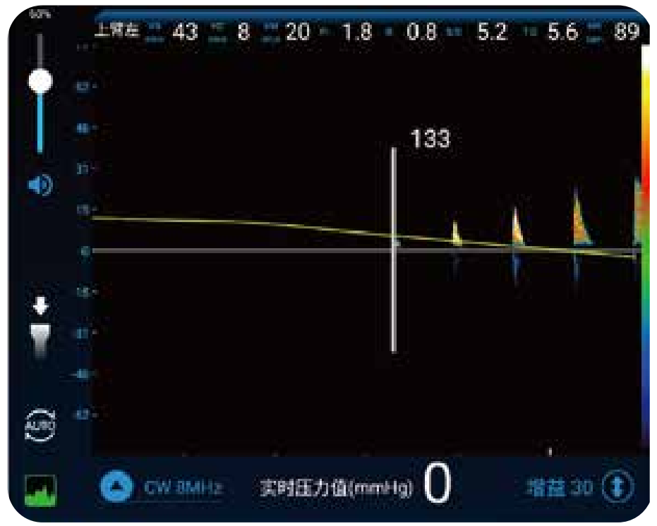 悦琦 血压脉搏检测仪  VBP-10D产品优势