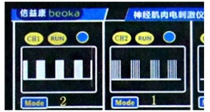 倍益康beoka 神经肌肉电刺激仪 QL/N-IV（四通道）产品优势