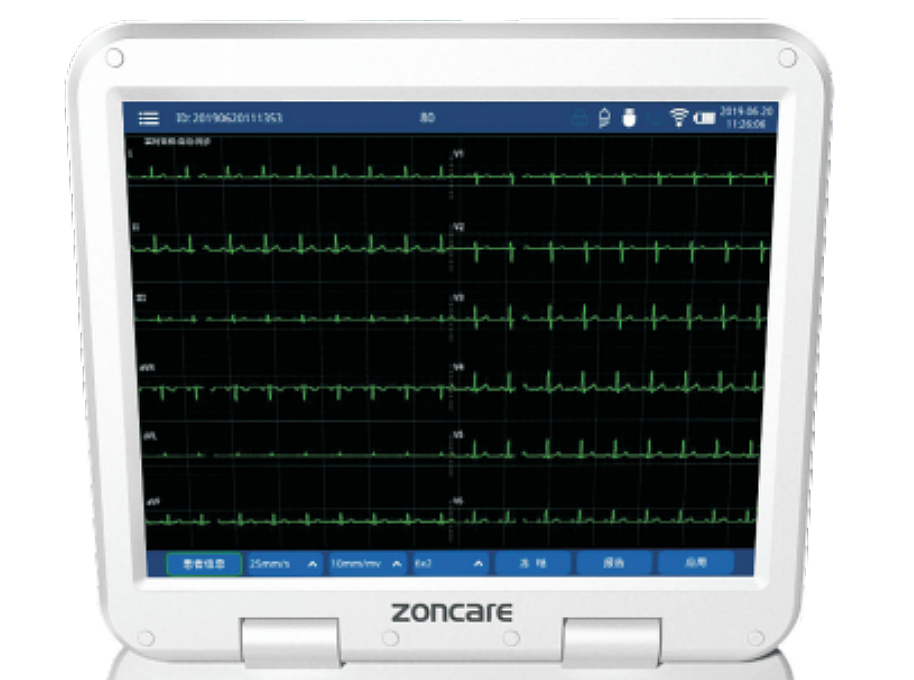 中旗Zoncare  数字式多道心电图机   iMAC 1200产品优势