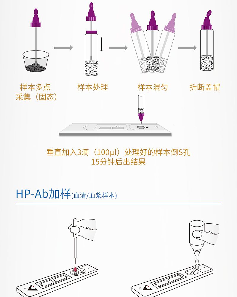 幽门螺旋杆菌_08.jpg