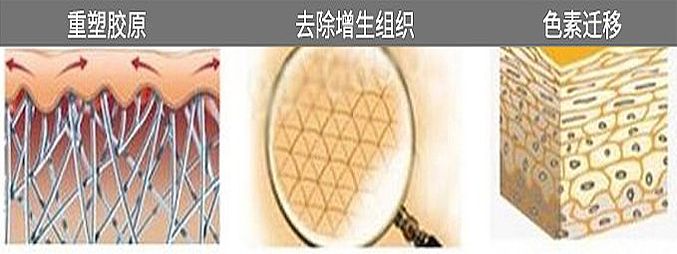 金莱特 二氧化碳激光治疗机 JLT-100A产品细节