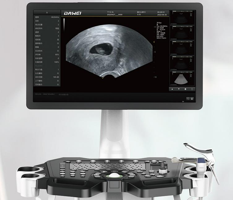 大为 彩超可视人流诊疗系统 DW-V5产品优势