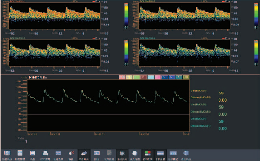 德力凯Delica  超声经颅多普勒血流分析仪  EMS-9EB产品细节