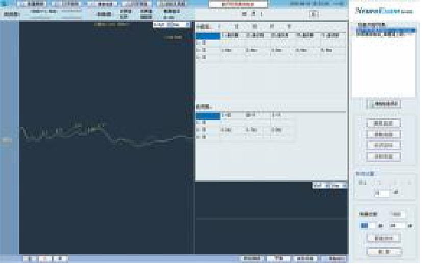 迈康MEDCOM 肌电图仪 M-8000C产品优势