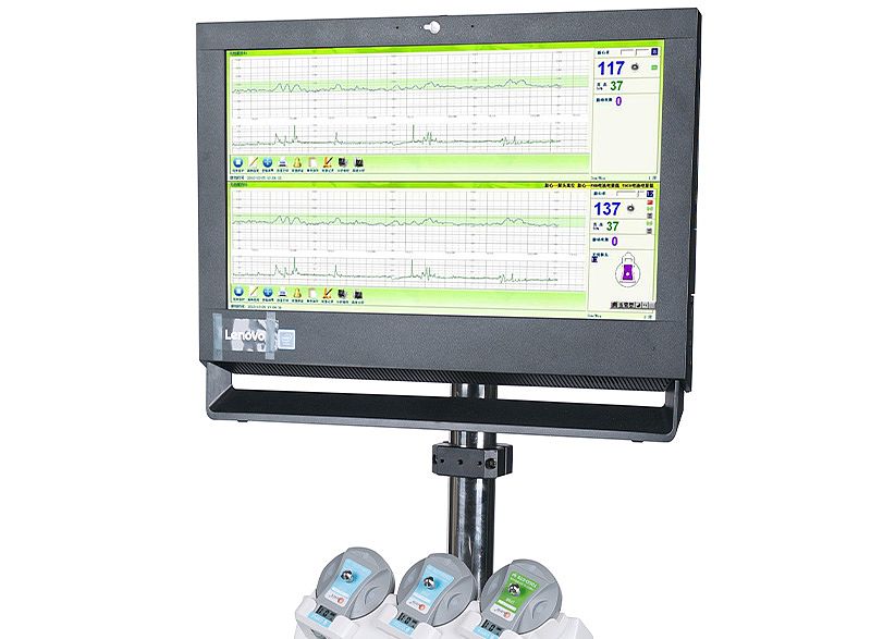 三瑞Sunray 电脑胎儿监护仪 SRF618A（单胎）产品优势