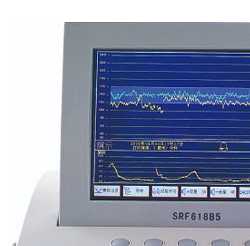 三瑞Sunray 电脑胎儿监护仪 SRF618B5（双胎）产品优势