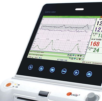 三瑞Sunray 电脑胎儿监护仪 SRF618B6（单胎）产品优势