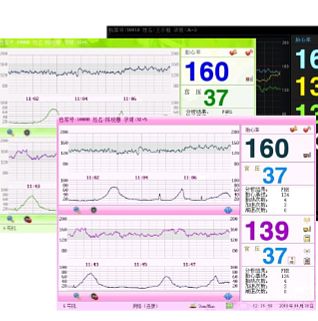 三瑞Sunray 电脑胎儿监护仪 SRF618B6（标准型）产品细节