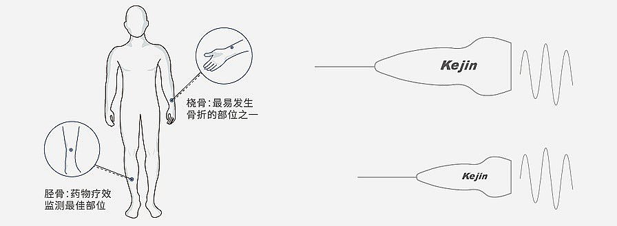 科进Kejin 超声骨密度仪 OSTEOKJ7000++双屏产品优势