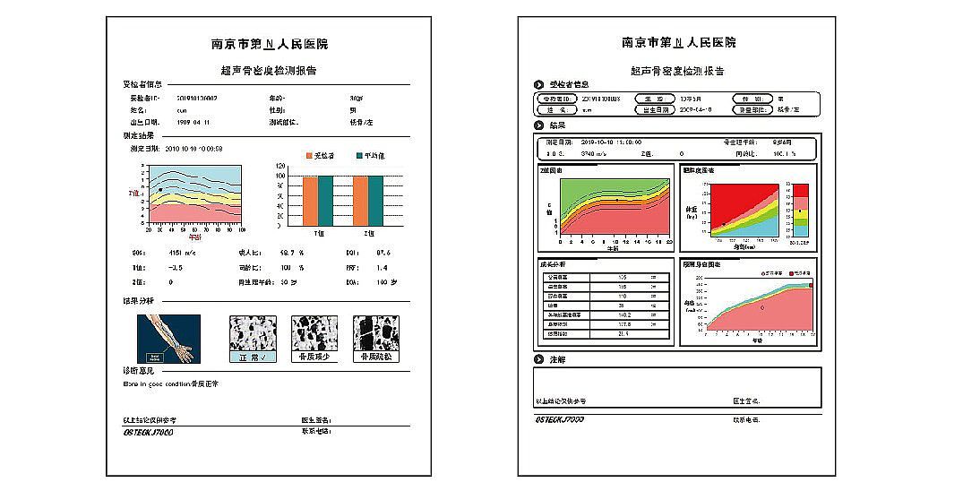 科进Kejin 超声骨密度仪 OSTEOKJ7000++双屏产品细节