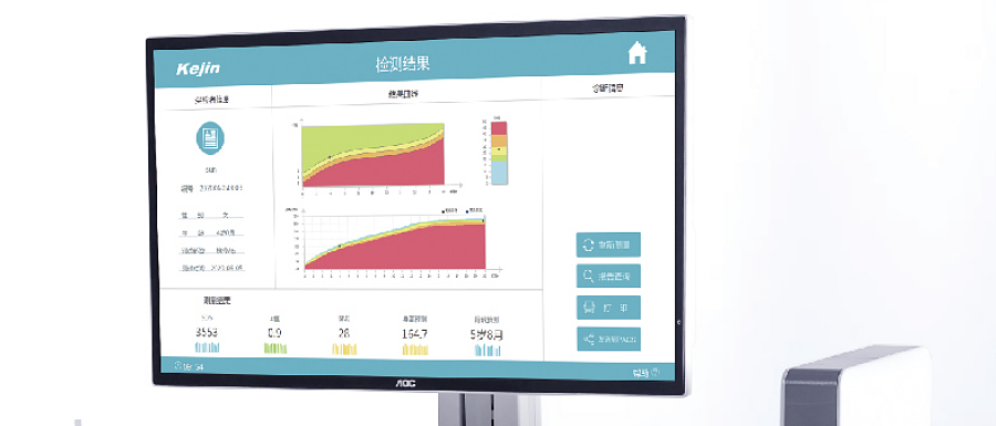 科进Kejin 超声骨密度仪 OSTEOKJ7000++（单屏）产品优势