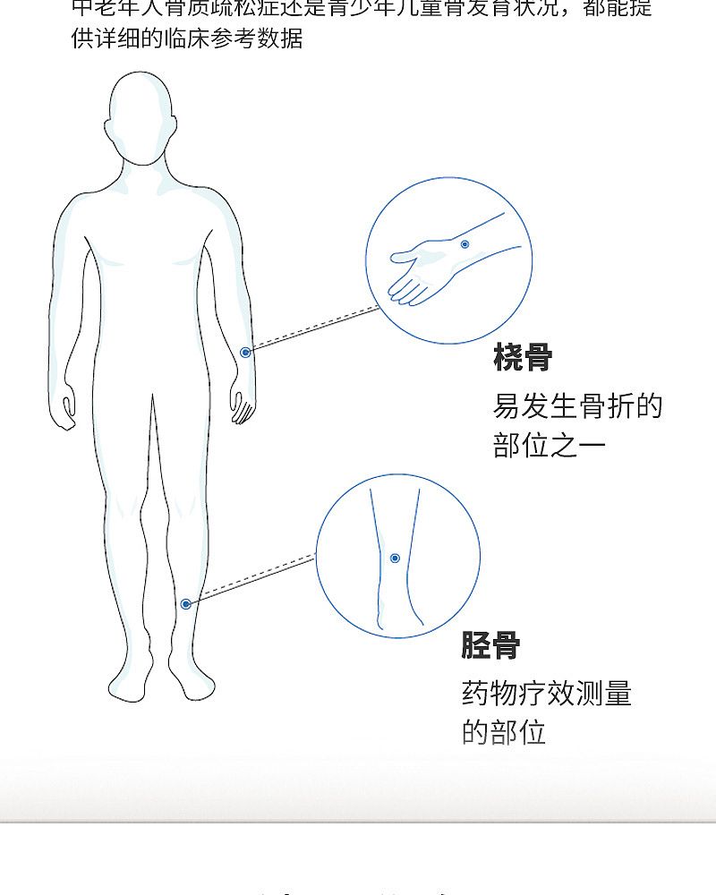 OSTEOKJ7000+便携式_03.jpg