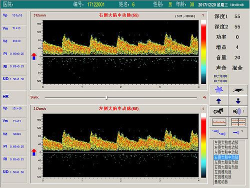 科进Kejin 超声经颅多普勒血流分析仪 KJ-2V7M产品优势