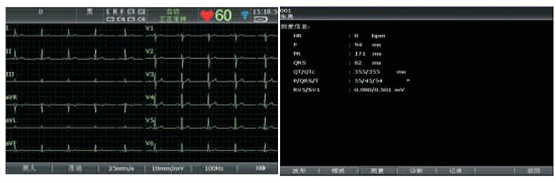 理邦EDAN 数字式十二道心电图机 SE-1201产品优势
