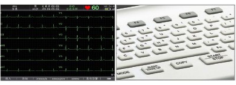 理邦EDAN 数字式十二道心电图机 SE-1200 Express产品优势