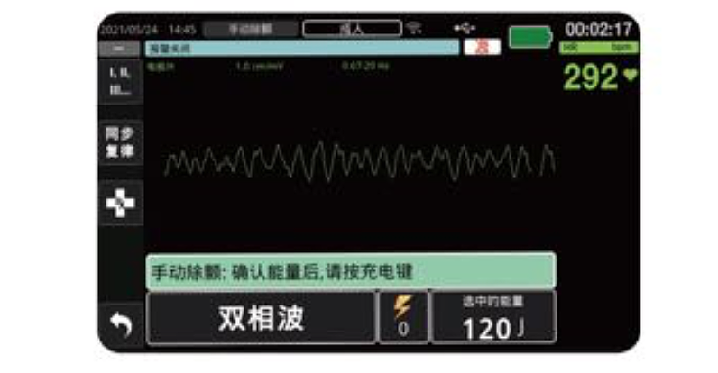 卓尔 ZOLL 体外除颤监护仪 ZOLL M2产品优势