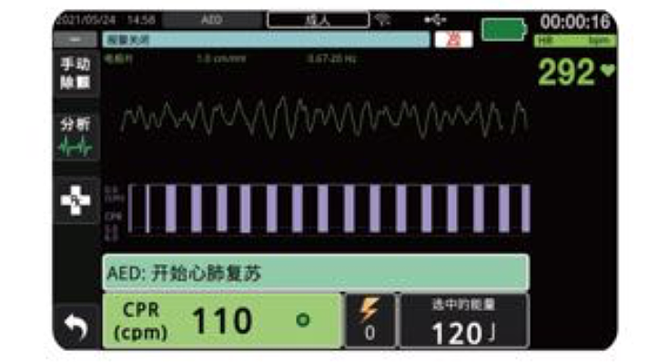 卓尔 ZOLL 体外除颤监护仪 ZOLL M2产品优势