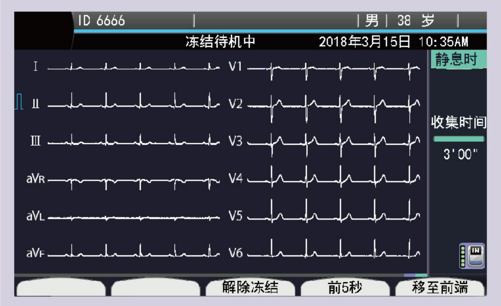 日本光电NIHON KOHDEN 六道心电图机 ECG-2250产品细节