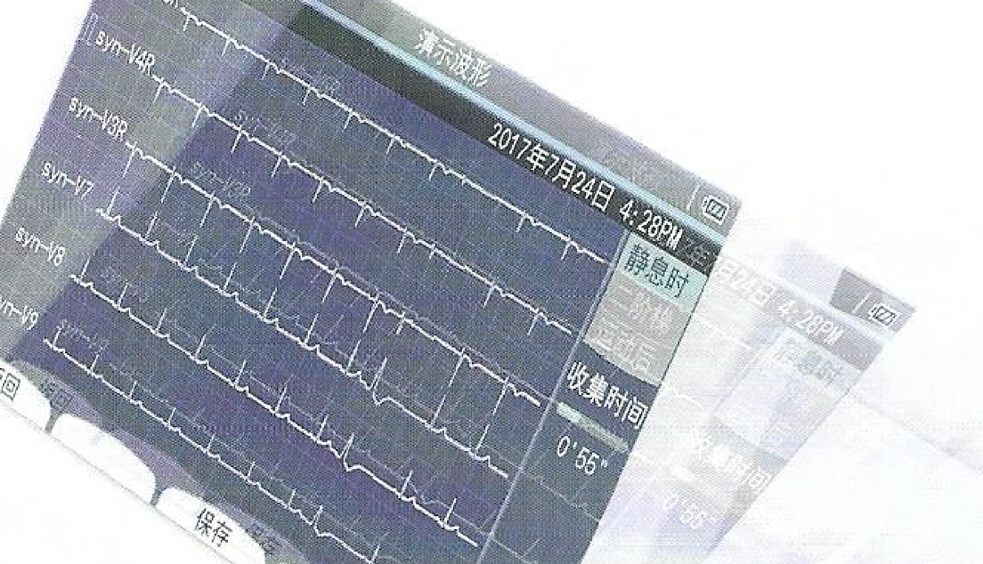 日本光电NIHON KOHDEN 心电图机 ECG-2360产品优势