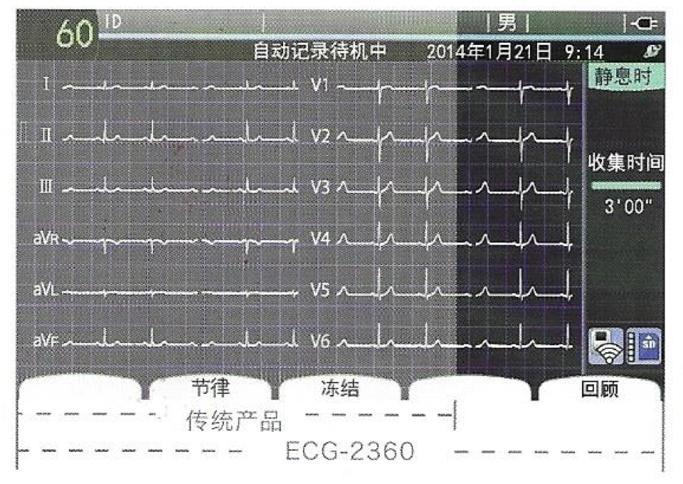 日本光电NIHON KOHDEN 心电图机 ECG-2360产品优势