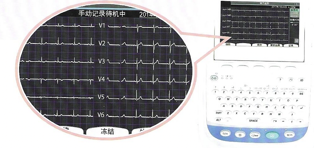 日本光电NIHON KOHDEN 心电图机 ECG-2360产品优势