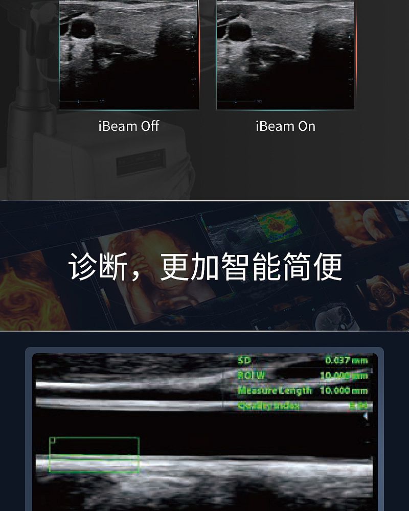 DC-26彩色多普勒超声系统_07.jpg