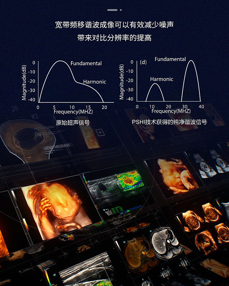 DC-26彩色多普勒超声系统_04.jpg