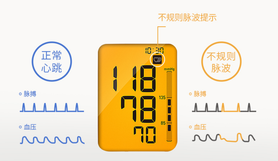 欧姆龙OMRON 电子血压计 U30产品优势