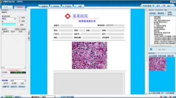 病理图文系统/病理图文软件/病理图文报告/病理图文分析系统