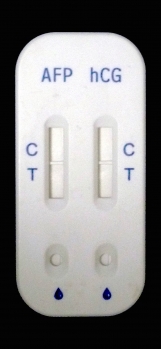 唐氏综合症检测试剂盒(胶体金法)