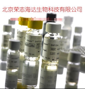 艾狄斯®骨碱性磷酸酶检测试剂盒（酶联免疫法）